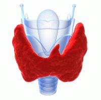 Аденома щитовидной железы