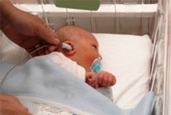 Скрининговая проверка слуха у новорожденных. Клиника Шиба (Израиль)