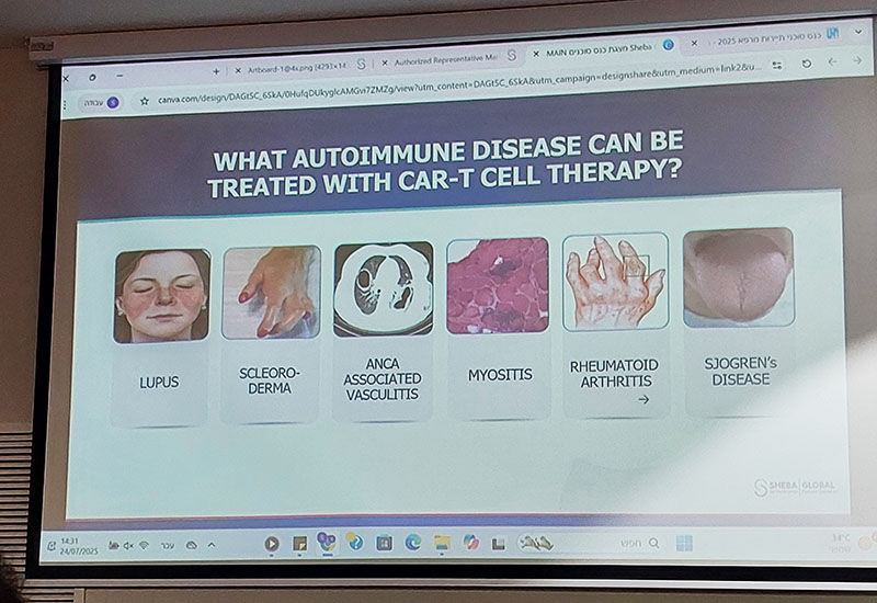 car-t-therapy-autoimmune-diseases-israel.jpg