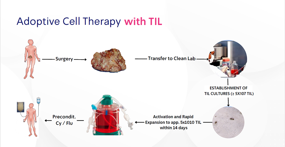 what-is-til-melanoma-treatment.png